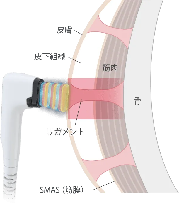 肌のたるみの根本原因に丸ごとアプローチ